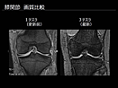 MRI画像